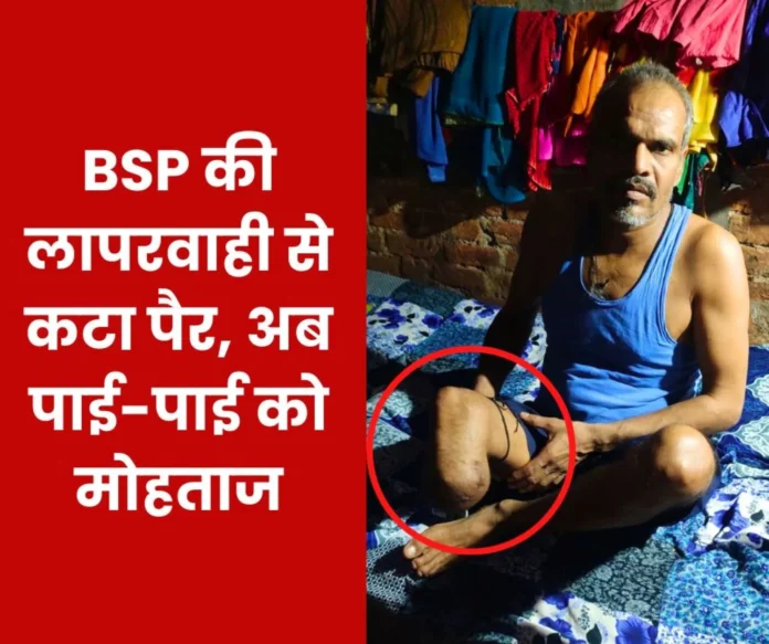 Leg was amputated in SAIL BSP accident, victim's letter to Deputy Director Health and Safety Leg was amputated in SAIL BSP accident, victim's letter to Deputy Director Health and Safety