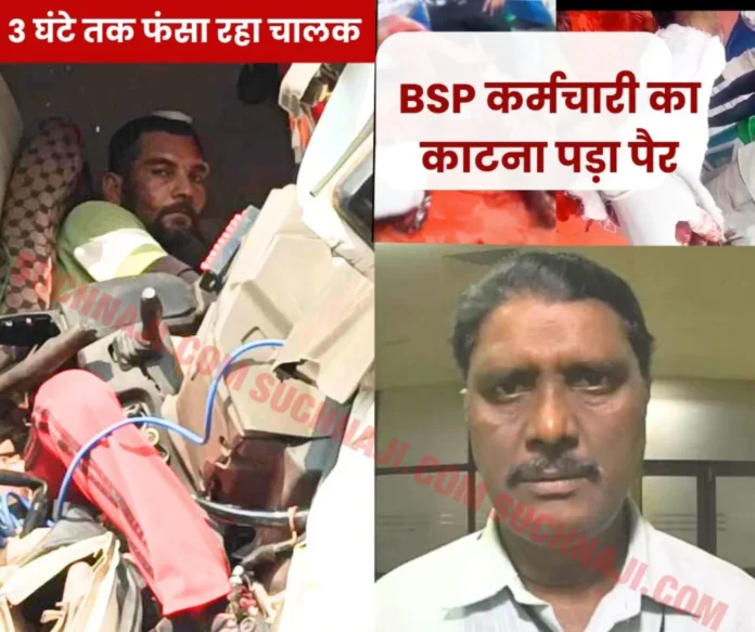 Bhilai Steel Plant employee injured in road accident, leg amputated, driver admitted Bhilai Steel Plant employee injured in road accident, leg amputated, driver admitted